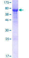 12.5% SDS-PAGE Stained with Coomassie Blue.